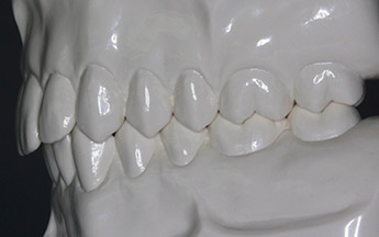 3. Harmonische Zahnstellung links